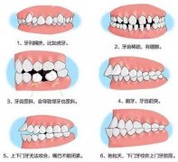 5类人不能做牙齿整形：不是所有人都能做，来看看你适合吗？