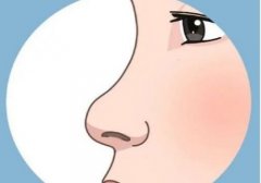 微创隆鼻整容可以做吗？多久可以稳定？