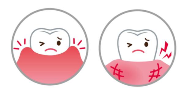 牙龈肿痛有脓包怎么办?